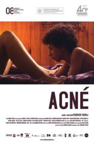 Acne (2008) +18